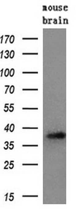 PRTN3 Monoclonal Antibody (OTI6A10), TrueMAB , OriGene:Antibodies:Primary
