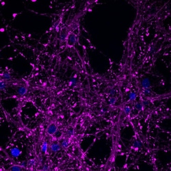 Invitrogen PSD-95 Polyclonal Antibody 100 &mu;g; Unconjugated:Antibodies,