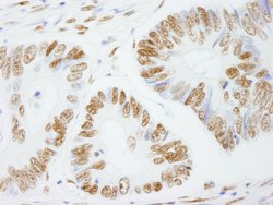 PSF/SFPQ Polyclonal Antibody, Bethyl Laboratories 100 &mu;L; Unconjugated:Antibodies,