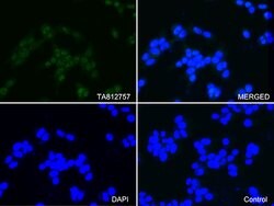 PSMA1 Monoclonal Antibody (OTI9H1), TrueMAB , OriGene 100 &mu;L | Buy Online | Origene Technologies | Fisher Scientific