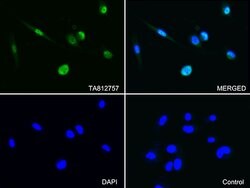 PSMA1 Monoclonal Antibody (OTI9H1), TrueMAB , OriGene 100 &mu;L | Buy Online | Origene Technologies | Fisher Scientific