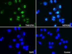 PSMA1 Mouse anti-Human, Clone: OTI6C4, lyophilized, TrueMAB 100 &mu;g;