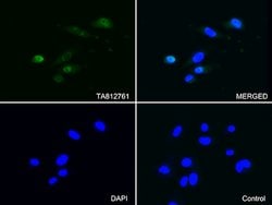 PSMA1 Mouse anti-Human, Clone: OTI6C4, lyophilized, TrueMAB 100 &mu;g;