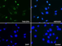 PSMA1 Mouse anti-Human, Clone: OTI6C4, lyophilized, TrueMAB 100 &mu;g;