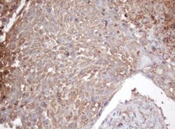 PSMA2 Monoclonal Antibody (OTI3B3), TrueMAB , OriGene:Antibodies:Primary