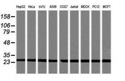PSMA2 Monoclonal Antibody (OTI4D12), TrueMAB , OriGene 100 &mu;L; Unconjugated:Antibodies,