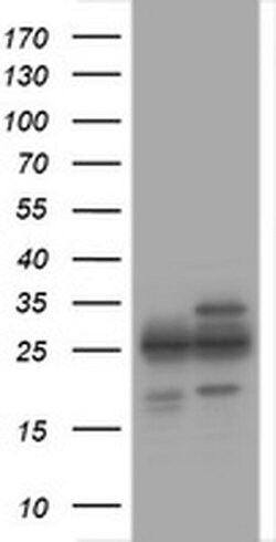 PSMA2 Monoclonal Antibody (OTI3E9), TrueMAB , OriGene:Antibodies:Primary