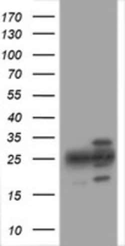 PSMA2 Mouse anti-Human, Clone: OTI3E2, lyophilized, TrueMAB 100 &mu;g;