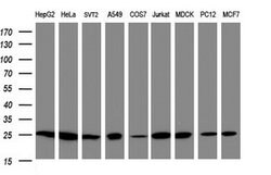 PSMA2 Mouse anti-Human, Clone: OTI3E2, lyophilized, TrueMAB 100 &mu;g;