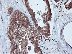 PSMA4 Monoclonal Antibody (OTI5D8), TrueMAB , OriGene 30 &mu;L; Unconjugated:Antibodies,