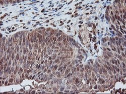 PSMA4 Monoclonal Antibody (OTI5D8), TrueMAB , OriGene 30 &mu;L; Unconjugated:Antibodies,