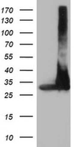 PSMA4 Monoclonal Antibody (OTI5D8), TrueMAB , OriGene 30 &mu;L; Unconjugated:Antibodies,