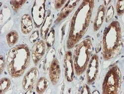 PSMA6 Monoclonal Antibody (OTI4C9), TrueMAB , OriGene 100 &mu;L; Unconjugated:Antibodies,