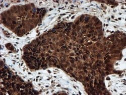 PSMA6 Monoclonal Antibody (OTI5H3), TrueMAB , OriGene 100 &mu;L; Unconjugated:Antibodies,