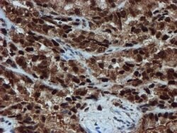 PSMA6 Monoclonal Antibody (OTI5H3), TrueMAB , OriGene 100 &mu;L; Unconjugated:Antibodies,