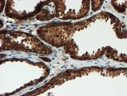 PSMA6 Monoclonal Antibody (OTI5H3), TrueMAB , OriGene 100 &mu;L; Unconjugated:Antibodies,
