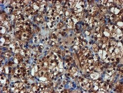 PSMA6 Monoclonal Antibody (OTI5H3), TrueMAB , OriGene 100 &mu;L; Unconjugated:Antibodies,