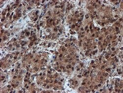 PSMA6 Monoclonal Antibody (OTI5H3), TrueMAB , OriGene 100 &mu;L; Unconjugated:Antibodies,