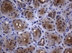 PSMA6 Mouse anti-Human, Clone: OTI1C4, lyophilized, TrueMAB 100 &mu;g;