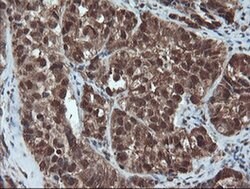 PSMA6 Monoclonal Antibody (OTI7C2), TrueMAB , OriGene 100 &mu;L; Unconjugated:Antibodies,