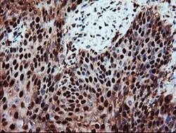 PSMA6 Monoclonal Antibody (OTI7C2), TrueMAB , OriGene 100 &mu;L; Unconjugated:Antibodies,