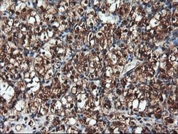 PSMA6 Monoclonal Antibody (OTI7C2), TrueMAB , OriGene 100 &mu;L; Unconjugated:Antibodies,