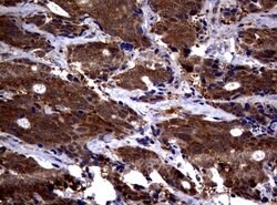 PSMA6 Mouse anti-Canine, Human, Mouse, Rat, Clone: UMAB102, lyophilized, UltraMAB 100 &mu;g | Buy Online | Origene Technologies | Fisher Scientific