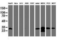 PSMA6 Monoclonal Antibody (OTI5H3), TrueMAB , OriGene 100 &mu;L; Unconjugated:Antibodies,