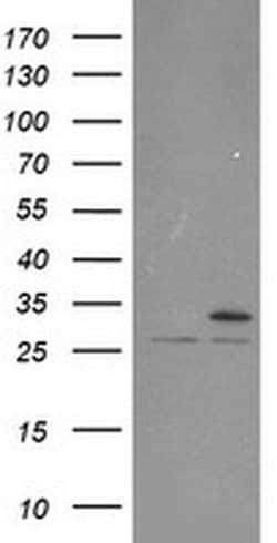 PSMA6 Monoclonal Antibody (OTI2A6), TrueMAB , OriGene 100 &mu;L; Unconjugated:Antibodies,
