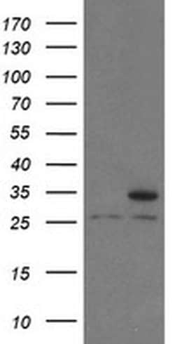PSMA6 Monoclonal Antibody (OTI1F3), TrueMAB , OriGene 100 &mu;L; Unconjugated:Antibodies,