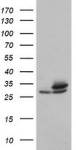 PSMA6 Mouse anti-Canine, Human, Mouse, Rat, Clone: OTI7C2, lyophilized,