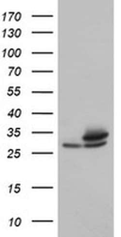 PSMA6 Monoclonal Antibody (OTI7C2), TrueMAB , OriGene 100 &mu;L; Unconjugated:Antibodies,