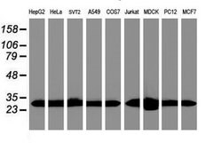 PSMA6 Mouse anti-Canine, Human, Mouse, Rat, Clone: OTI7C2, lyophilized,
