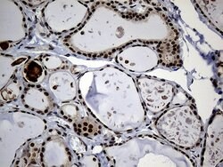 PSMA7 Mouse anti-Human, Clone: OTI5F6, lyophilized, TrueMAB 100 &mu;g;