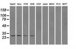PSMA7 Mouse anti-Human, Clone: OTI2A7, lyophilized, TrueMAB 100 &mu;g;