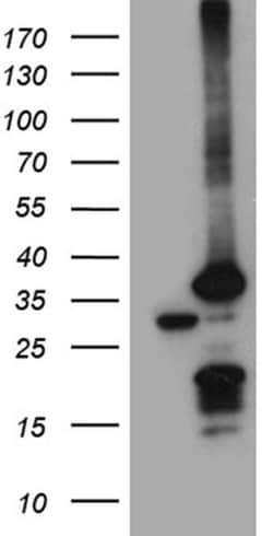 PSMA7 Mouse anti-Human, Clone: OTI10A6, TrueMAB , Origene 30 &mu;L; Unconjugated:Antibodies,