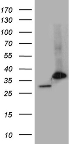 PSMA7 Mouse anti-Human, Clone: OTI5F6, lyophilized, TrueMAB 100 &mu;g;