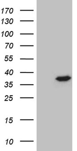 PSMA7 Monoclonal Antibody (OTI9B6), TrueMAB , OriGene 30 &mu;L | Buy Online | Origene Technologies | Fisher Scientific