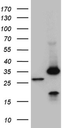 PSMA7 Monoclonal Antibody (OTI8B11), TrueMAB , OriGene:Antibodies:Primary