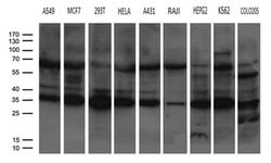 PSMA7 Monoclonal Antibody (OTI8B11), TrueMAB , OriGene:Antibodies:Primary