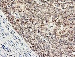PSMB4 Mouse anti-Human, Clone: OTI2C9, liquid, TrueMAB 100 &mu;L; Unconjugated:Antibodies,
