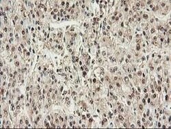 PSMB4 Mouse anti-Human, Clone: OTI2C9, liquid, TrueMAB 100 &mu;L; Unconjugated:Antibodies,