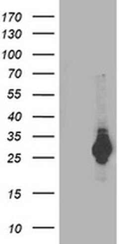 PSMB4 Monoclonal Antibody (OTI5B5), TrueMAB , OriGene 100 &mu;L; Unconjugated:Antibodies,