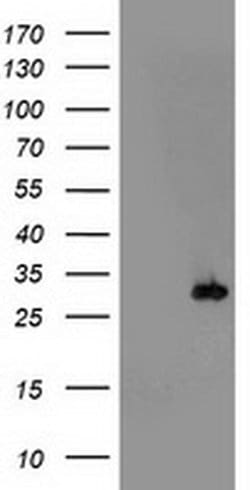 PSMB4 Monoclonal Antibody (OTI6F10), TrueMAB , OriGene:Antibodies:Primary