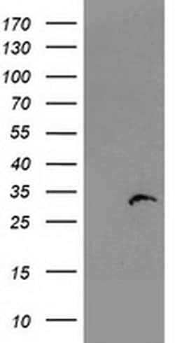 PSMB4 Monoclonal Antibody (OTI1F8), TrueMAB , OriGene:Antibodies:Primary