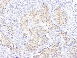 PSMB5 Rabbit anti-Human, Polyclonal, Bethyl Laboratories 100 &mu;L; Unconjugated:Antibodies,