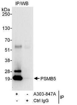 PSMB5 Rabbit anti-Human, Polyclonal, Bethyl Laboratories 100 &mu;L; Unconjugated:Antibodies,