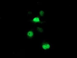 PSMB7 Monoclonal Antibody (OTI4G9), TrueMAB , OriGene:Antibodies:Primary