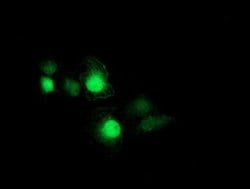 PSMB7 Monoclonal Antibody (OTI4E3), TrueMAB , OriGene 30 &mu;L; Unconjugated:Antibodies,
