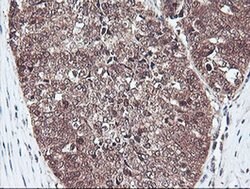 PSMB7 Monoclonal Antibody (OTI1D1), TrueMAB , OriGene 100 &mu;L; Unconjugated:Antibodies,